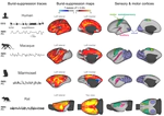 Spatial signatures of anesthesia-induced burst-suppression differ between primates and rodents