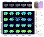 Lack of astrocytes hinders parenchymal oligodendrocyte precursor cells from reaching a myelinating state in osmolyte-induced demyelination