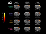 Temporal stability of fMRI in medetomidine-anesthetized rats