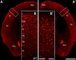 Increased Callosal Connectivity in Reeler Mice Revealed by Brain-Wide Input Mapping of VIP Neurons in Barrel Cortex